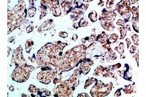 Immunohistochemical analysis of paraffin-embedded Human-placenta, antibody was diluted at 1:100 (BMPR1B antibody  (AA 21-70))