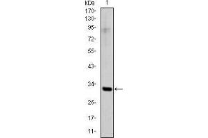 Western blot analysis using SNAI1 mAb against human SNAI1 (AA: 2-264) recombinant protein. (SNAIL antibody)