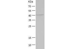 Western Blotting (WB) image for KIAA0513 (KIAA0513) (AA 1-401) protein (His tag) (ABIN7123684) (KIAA0513 Protein (KIAA0513) (AA 1-401) (His tag))
