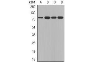 Western blot analysis of Calpain 5 expression in A431 (A), SKOV3 (B), mouse thymus (C), mouse brain (D) whole cell lysates. (Calpain 5 antibody)
