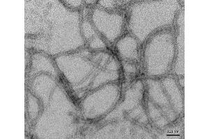 TEM of recombinant Tau (K18), P301L mutant Pre-formed Fibrils (PFFs) at 150kx magnification. (tau Protein (partial, Pro301Leu-Mutant))