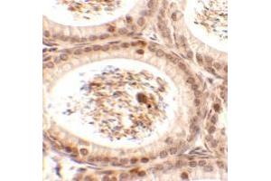 Immunohistochemistry of SPATA3 in mouse testis tissue with SPATA3 antibody at 2. (SPATA3 antibody  (C-Term))