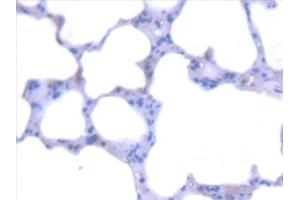 Detection of AGXT in Mouse Lung Tissue using Polyclonal Antibody to Alanine Glyoxylate Aminotransferase (AGXT) (AGXT antibody  (AA 120-334))