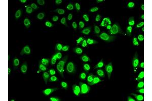 Immunofluorescence analysis of A-549 cells using FIP1L1 antibody (ABIN6131645, ABIN6140640, ABIN6140641 and ABIN6222954). (FIP1L1 antibody  (AA 1-300))