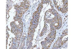 IHC analysis of RPL32 using anti-RPL32 antibody (ABIN7602916).