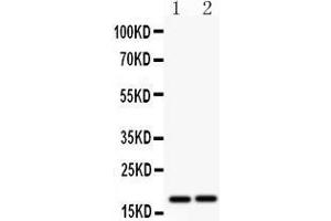 Anti- CASP8 antibody, Western blotting All lanes: Anti CASP8  at 0. (Caspase 8 antibody  (N-Term))