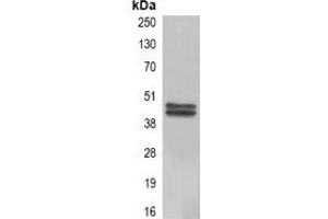 Immunoprecipitation of Carbonic Anhydrase 9 from 0. (CA9 antibody)