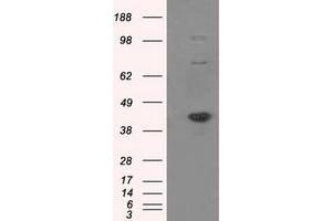 Image no. 1 for anti-Nucleotide Exchange Factor SIL1 (SIL1) antibody (ABIN1496809)