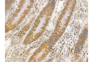 ABIN6262097 and ABIN6266556 at 1/100 staining human normal colon tissue by IHC-P. (HSPA9 antibody  (C-Term))