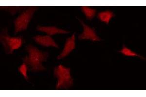 Immunofluorescence (fixed cells) (IF/ICC) image for anti-Eukaryotic Translation Initiation Factor 2-alpha Kinase 2 (EIF2AK2) (pThr446) antibody (ABIN6255690)