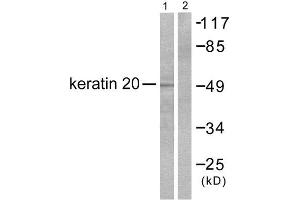 Western Blotting (WB) image for anti-Keratin 20 (KRT20) (C-Term) antibody (ABIN1848637) (KRT20 antibody  (C-Term))