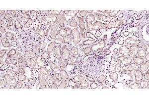 Paraformaldehyde-fixed, paraffin embedded Human kidney; Antigen retrieval by boiling in sodium citrate buffer (pH6. (CLEC9A antibody  (AA 101-200))