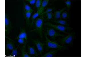 Immunofluorescence microscopy of Rabbit Anti-alpha-Tubulin antibody using HeLa cells fixed with PFA. (alpha Tubulin antibody  (Internal Region))