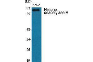 Western Blot (WB) analysis of specific cells using Histone deacetylase 9 Polyclonal Antibody. (HDAC9 antibody  (C-Term))