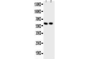 Anti-Src Picoband antibody,  All lanes: Anti-Src at 0. (Src antibody  (AA 2-368))