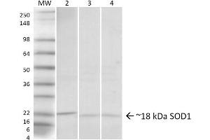 Western blot analysis of Human, Rat, Mouse Hela cells, Brain, Lung showing detection of ~18 kDa SOD1 (UBB) protein using Rabbit Anti-SOD1 (UBB) Polyclonal Antibody . (SOD1 antibody  (N-Term) (Atto 390))