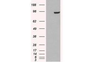 Image no. 1 for anti-phosphodiesterase 5A, cGMP-Specific (PDE5A) (C-Term) antibody (ABIN374520) (PDE5A antibody  (C-Term))