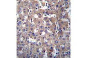 Immunohistochemistry analysis of GGT2 Antibody (N-term) in formalin fixed and paraffin embedded human liver tissue followed by peroxidase conjugation of the secondary antibody and DAB staining. (gGT2 antibody  (N-Term))