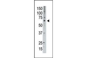 Image no. 1 for anti-Melanoma Antigen Family D, 2 (MAGED2) (C-Term) antibody (ABIN358658) (MAGED2 antibody  (C-Term))