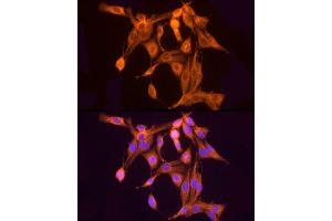 Immunofluorescence analysis of PC-12 cells using ULBP2 Rabbit pAb (ABIN7271214) at dilution of 1:50 (40x lens). (ULBP2 antibody  (AA 26-216))