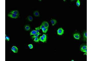 Immunofluorescent analysis of MCF-7 cells using ABIN7170573 at dilution of 1:100 and Alexa Fluor 488-congugated AffiniPure Goat Anti-Rabbit IgG(H+L) (S1PR3 antibody  (AA 303-378))