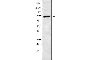 Western blot analysis of ATXN7 using HuvEc whole cell lysates (ATXN7 antibody  (Internal Region))