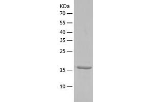 Western Blotting (WB) image for TGFB-Induced Factor Homeobox 2-Like, Y-Linked (TGIF2LY) (AA 1-185) protein (His tag) (ABIN7287846) (TGIF2LY Protein (AA 1-185) (His tag))