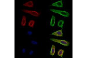 ABIN7094719 and ABIN7098770 staining Hela cells by IF/ICC. (GUCY1A2 antibody  (N-Term))