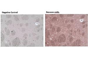 Immunohistochemistry analysis of formalin-fixed, paraffin-embedded rat brain tissue stained with Bassoon monoclonal antibody (SAP7F407),  at 10 μg/mL. (Bassoon antibody)