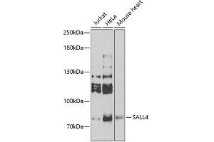 Western blot analysis of extracts of various cell lines, using SALL4 Antibody (ABIN6132627) at 1:1000 dilution. (SALL4 antibody  (AA 1-220))