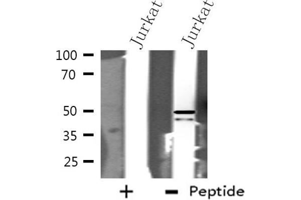 HNRNPH2 antibody  (Internal Region)
