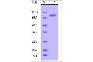 Mouse ROR2, Fc Tag on  under reducing (R) condition. (ROR2 Protein (AA 34-403) (Fc Tag))