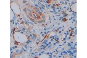 Figure. (Annexin a10 antibody  (AA 1-324))