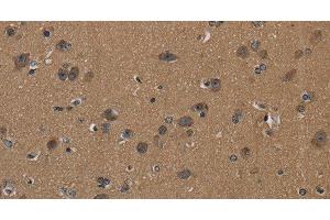 Immunohistochemistry of paraffin-embedded Human brain using CD242 Polyclonal Antibody at dilution of 1:50 (ICAM4 antibody)