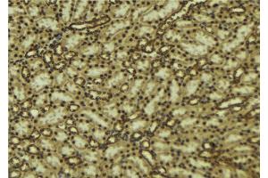 ABIN6277094 at 1/100 staining Mouse kidney tissue by IHC-P.