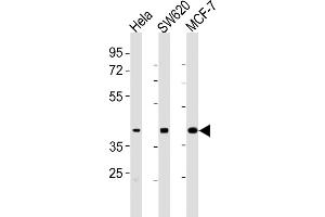 All lanes : Anti-HPN Antibody (Center) at 1:2000 dilution Lane 1: Hela whole cell lysates Lane 2: S whole cell lysates Lane 3: MCF-7 whole cell lysates Lysates/proteins at 20 μg per lane. (Hepsin antibody  (AA 153-188))