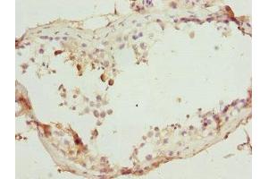 Immunohistochemistry of paraffin-embedded human testis tissue using ABIN7172439 at dilution of 1:100 (SUPT4H antibody  (AA 1-117))