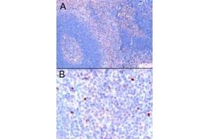 ABIN184677 (1µg/ml) staining of paraffin embedded Human Tonsil. (FOXP3 antibody  (C-Term))