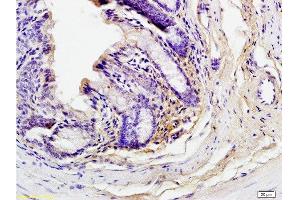 Formalin-fixed and paraffin embedded mouse small intestine tissue labeled with Anti-Phospho-GCN2 (Thr898) Polyclonal Antibody, Unconjugated  at 1:200 followed by conjugation to the secondary antibody and DAB staining (GCN2 antibody  (pThr899))