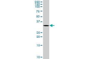 SNRPA MaxPab rabbit polyclonal antibody. (SNRPA1 antibody  (AA 1-282))