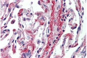 Human Lung (formalin-fixed, paraffin-embedded) stained with PODXL antibody ABIN462244 followed by biotinylated goat anti-rabbit IgG secondary antibody ABIN481713, alkaline phosphatase-streptavidin and chromogen. (PODXL antibody  (AA 301-350))