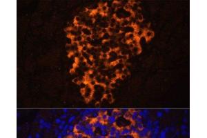 Immunofluorescence analysis of Rat pancreas using PNLIPRP2 Polyclonal Antibody at dilution of 1:100. (PNLIPRP2 antibody)