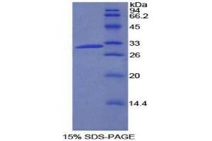 SDS-PAGE (SDS) image for Phosphatidylinositol-4-Phosphate 3-Kinase, Catalytic Subunit Type 2 beta (PIK3C2B) (AA 790-1025) protein (His tag) (ABIN2126289)
