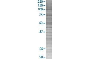 ADRB2 293T Cell Transient Overexpression Lysate(Denatured)
