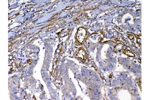IHC analysis of VEGF Receptor 3 using anti-VEGF Receptor 3 antibody . (FLT4 antibody  (AA 25-259))