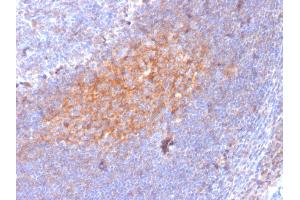 Formalin-fixed, paraffin-embedded human Lymph Node stained with CD81 Mouse Monoclonal Antibody (1.
