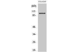 Western Blotting (WB) image for anti-Oculocerebrorenal Syndrome of Lowe (OCRL) (Internal Region) antibody (ABIN3185990) (OCRL antibody  (Internal Region))