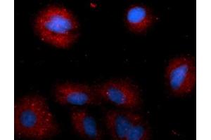 Immunofluorescence (IF) image for anti-Cathepsin E (CTSE) (AA 57-363) antibody (PE) (ABIN5565234) (Cathepsin E antibody  (AA 57-363) (PE))