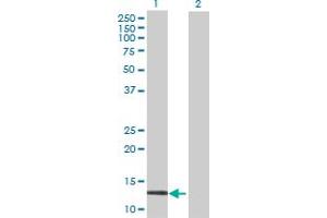 Western Blot analysis of CALML3 expression in transfected 293T cell line by CALML3 MaxPab polyclonal antibody. (CALML3 antibody  (AA 1-149))