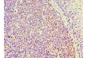 Immunohistochemistry of paraffin-embedded human tonsil tissue using ABIN7168802 at dilution of 1:100 (SEMA4C antibody  (AA 749-833))